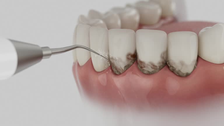 Reliable Dental contractor in Indian Hills, TX by Dentist Open Now